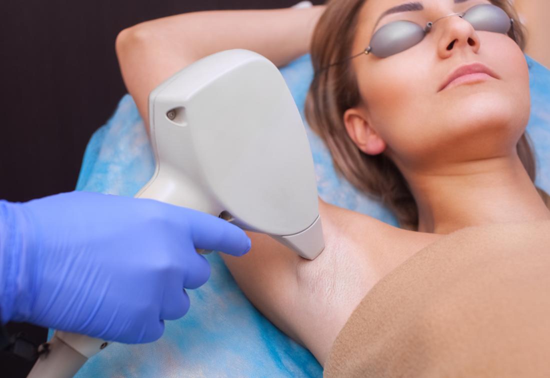 Laser Hair Removal: A Comprehensive Guide to Different Types and Their Suitability